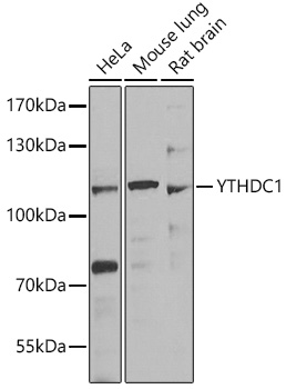 Anti-YTHDC1 Antibody (CAB7318)