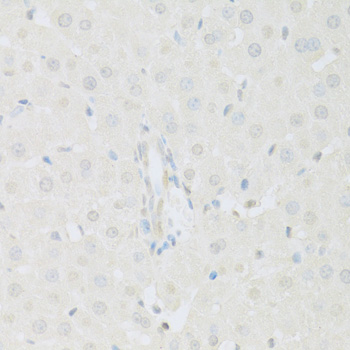 Anti-KAT2A Antibody (CAB2224)