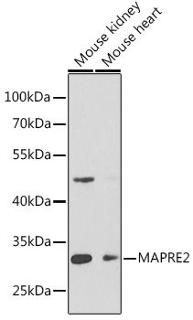 Anti-MAPRE2 Antibody (CAB6649)