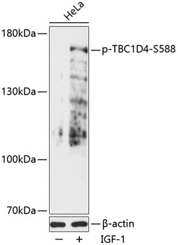 Anti-Phospho-TBC1D4-S588 pAb (CABP0790)