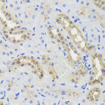 Anti-DISC1 Antibody (CAB2898)