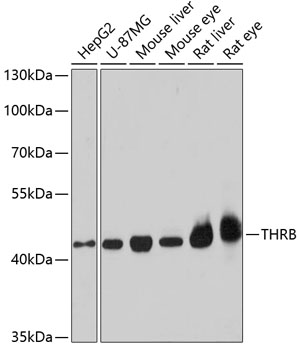 Anti-THRB Antibody (CAB1582)