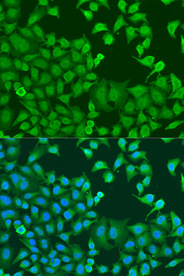 Anti-STAT3 Antibody (CAB15729)