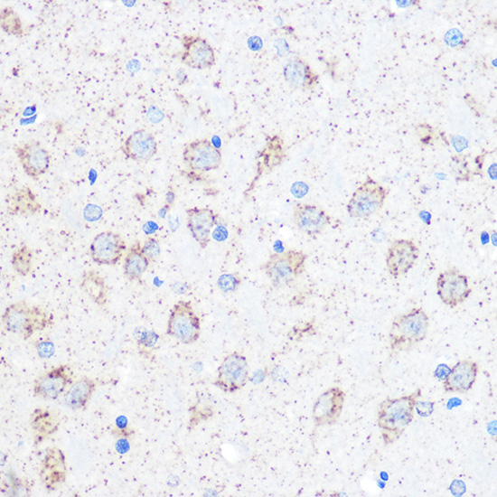 Anti-TFEB Antibody (CAB7311)