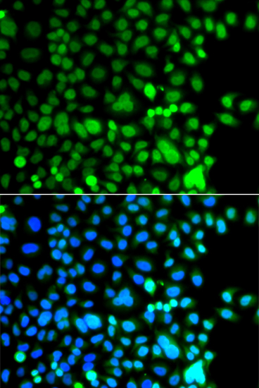 Anti-AEBP2 Antibody (CAB7400)