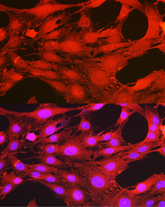 Anti-Phospho-PDK1-S241 Antibody (CABP0477)