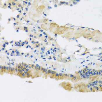 Anti-CLIP1 Antibody (CAB7722)