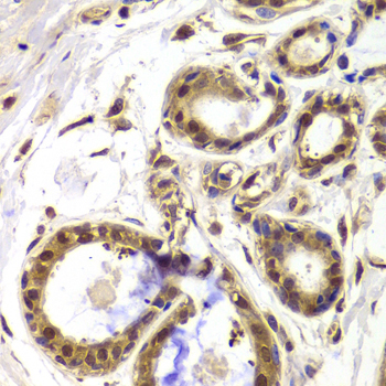 Anti-HDAC4 Antibody (CAB7951)