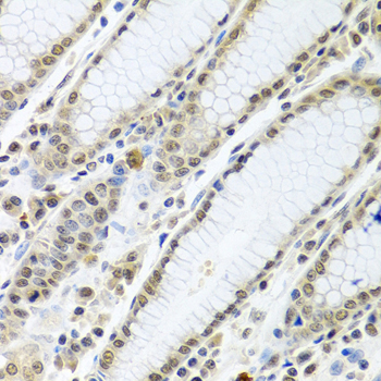 Anti-TIA1 Antibody (CAB12523)