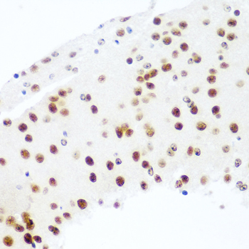 Anti-Argonaute-2 Antibody (CAB6023)