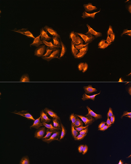 Anti-MRPS27 Antibody (CAB11667)