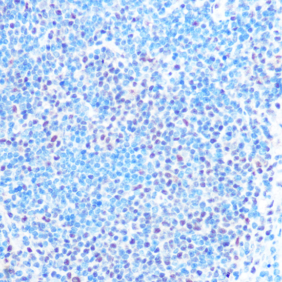 Anti-SNRPB Antibody (CAB2009)