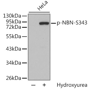 Anti-Phospho-Nibrin-S343 Antibody (CABP0413)