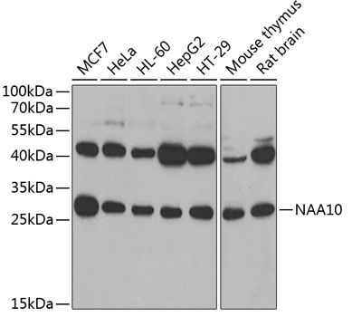 Anti-NAA10 Antibody (CAB7009)