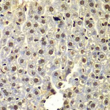 Anti-SSX5 Antibody (CAB7732)