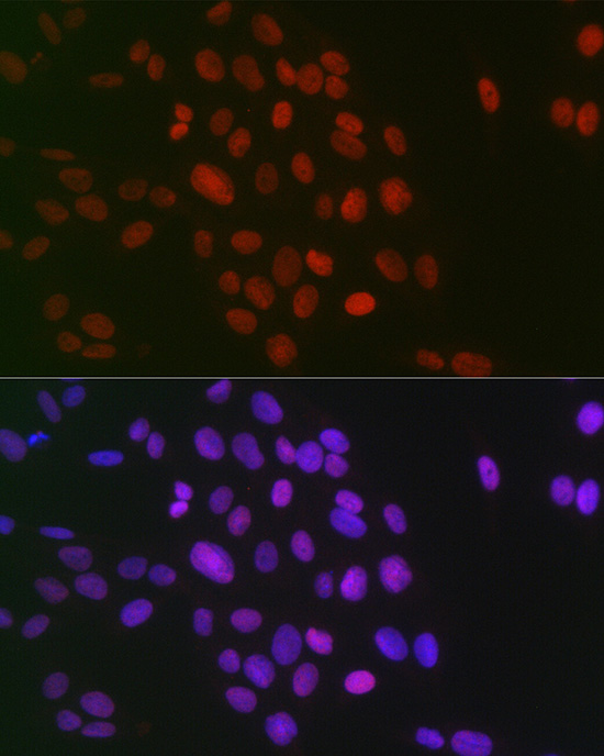 Anti-Symmetric DiMethyl-Histone H3-R26 Antibody (CAB3153)