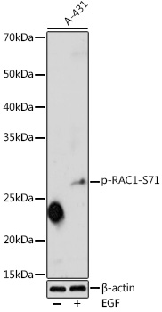 Anti-Phospho-RAC1-S71 Antibody (CABP0086)