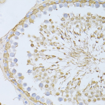 Anti-ENO3 Antibody (CAB3852)