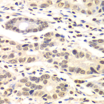 Anti-Cyclin C Antibody (CAB6545)