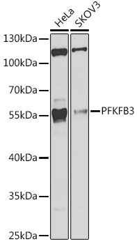 Anti-PFKFB3 Antibody (CAB6945)