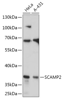 Anti-SCAMP2 Antibody (CAB17603)