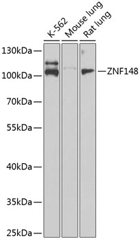 Anti-ZNF148 Antibody (CAB7001)