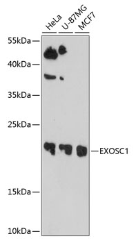 Anti-EXOSC1 Antibody (CAB10302)