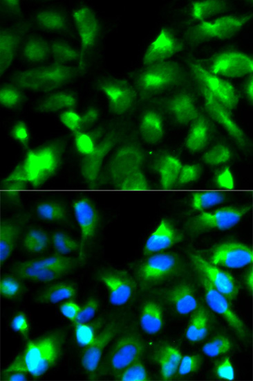 Anti-SNAP25 Antibody (CAB0986)