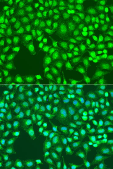 Anti-Defb26 Antibody (CAB15903)