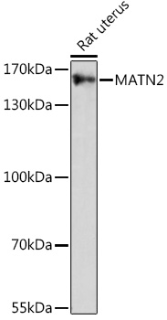 Anti-MATN2 Antibody (CAB16397)