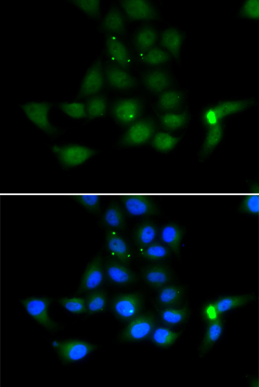 Anti-TAT Antibody (CAB6764)