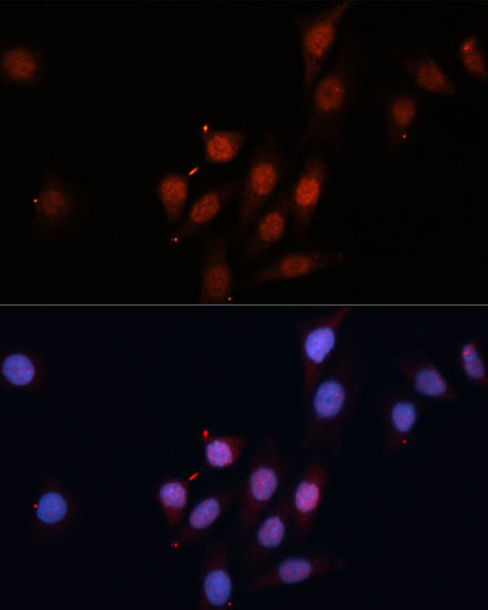 Anti-Smad5 Antibody (CAB1947)