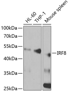 Anti-IRF8 Antibody (CAB5798)