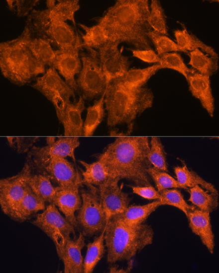 Anti-AOX1 Antibody (CAB3586)