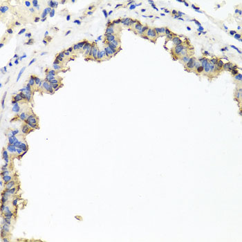 Anti-CXCR4 Antibody (CAB12534)