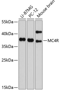 Anti-MC4R Antibody (CAB10228)