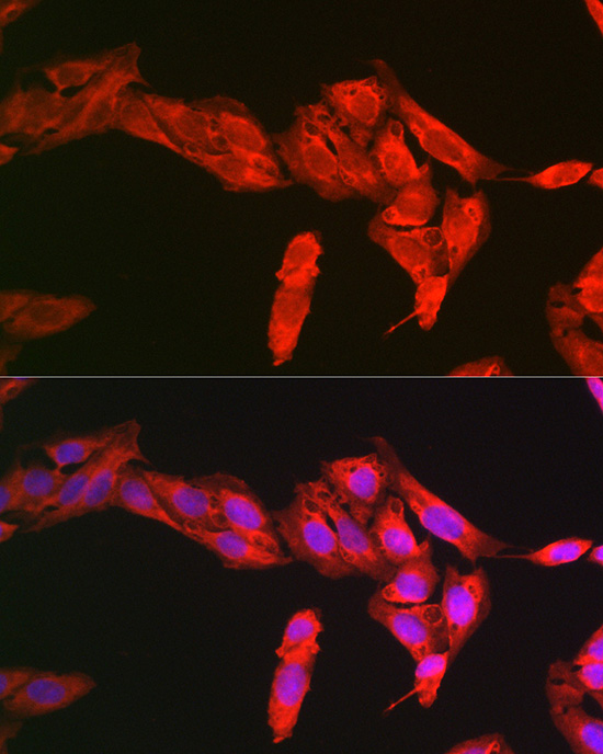 Anti-NRF2 Antibody (CAB1244)