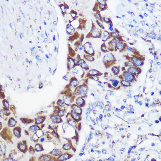 Anti-MTMR9 Antibody (CAB13124)