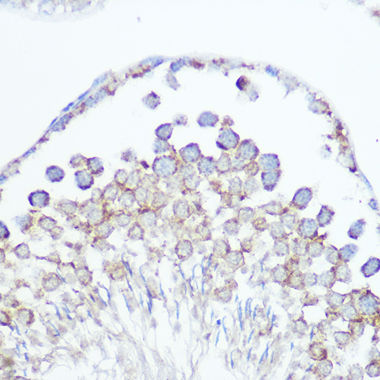 Anti-SOD2 Antibody [KO Validated] (CAB1340)