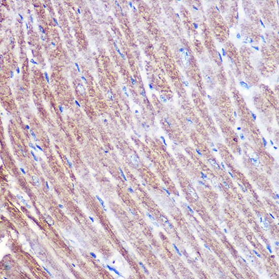 Anti-MYH1 Antibody (CAB6935)