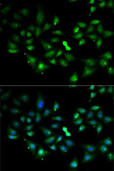 Anti-FLOT2 Antibody (CAB6590)