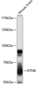 Anti-DTNB Antibody (CAB12866)