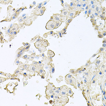 Anti-MMRN1 Antibody (CAB6658)