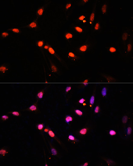 Anti-Kdm6b Antibody (CAB12763)