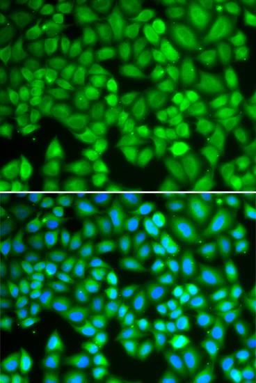 Anti-WAS Antibody (CAB0978)