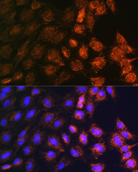 Anti-SLC25A22 Antibody [KO Validated] (CAB17772)