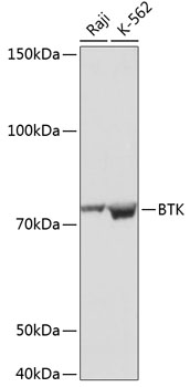 Anti-BTK Rabbit Monoclonal Antibody (CAB19002)