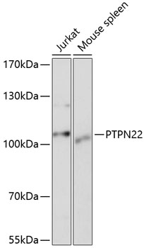 Anti-PTPN22 Antibody (CAB1406)