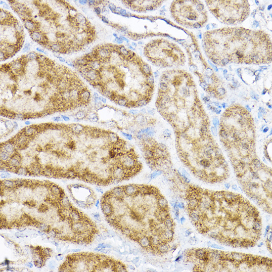 Anti-RPL4 Antibody (CAB5886)