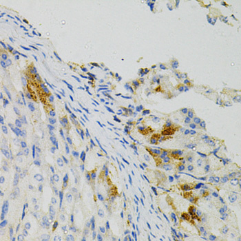 Anti-MSN Antibody (CAB12463)